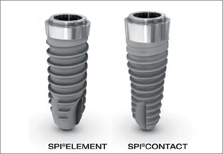 2つのラインのSPI®システム