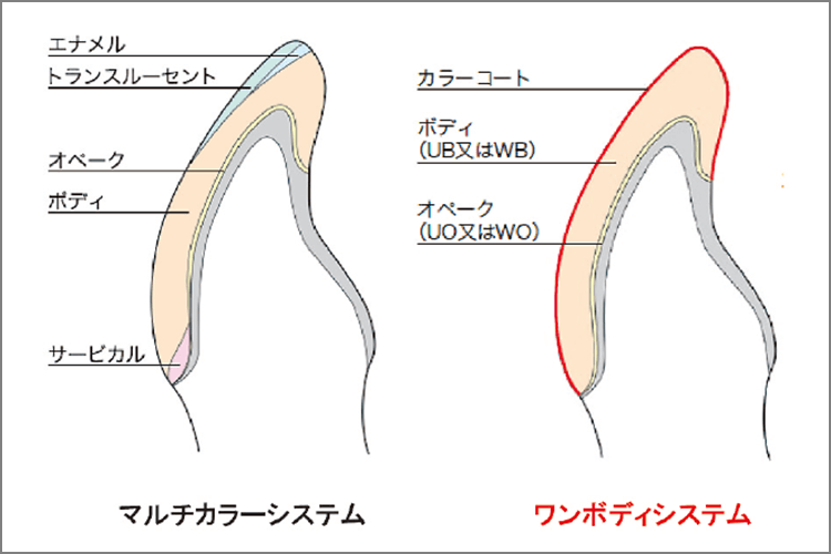 色調表現方法 ワンボディシステムは、オペークの上にボディを単層で築盛しカラーコートで色調表現するシステムです。