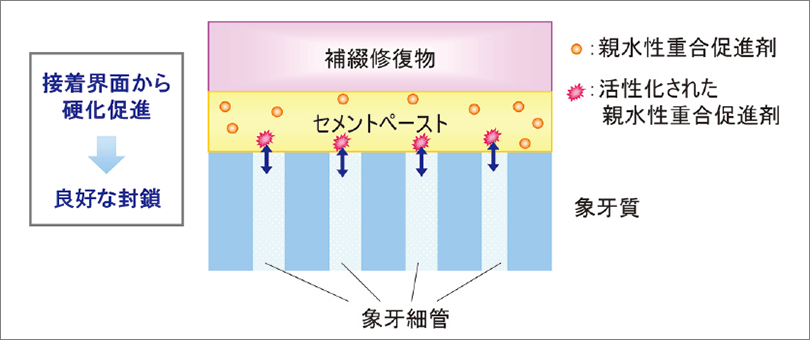 親水性重合促進剤のイメージ