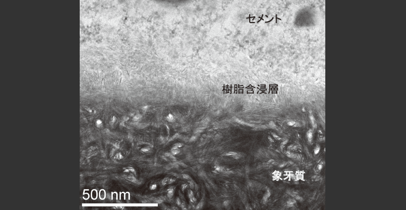 象牙質接着界面のTEM像