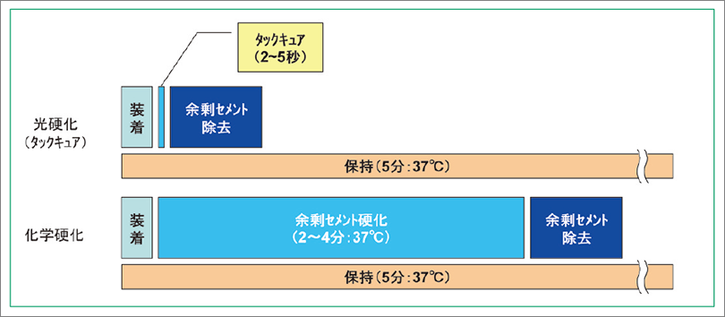 余剰セメントの除去方法（光硬化と化学硬化）