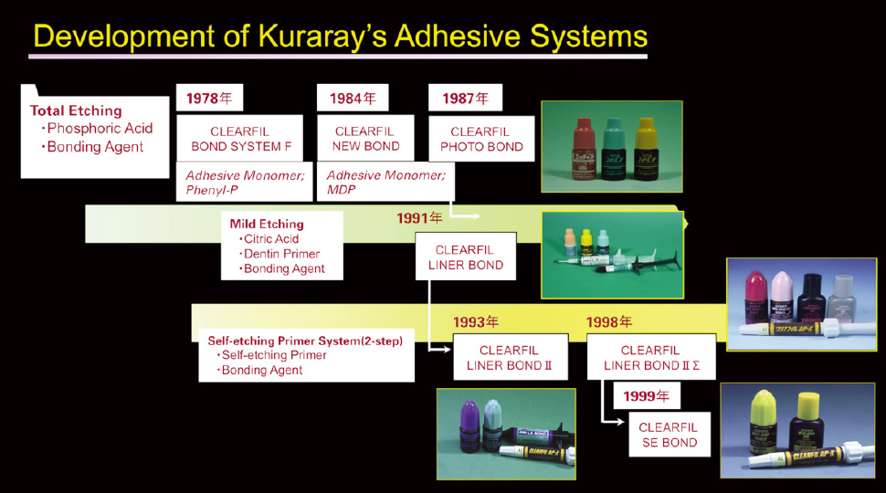 これまで開発された歯質接着システムとその歴史