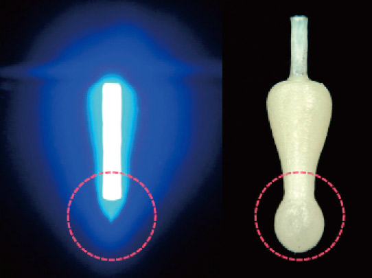 図10　光ファイバーにより確実に根尖部分のレジンが重合でき、光重合レジンを用いても確実な支台築造が可能となった（サンメディカル提供）。