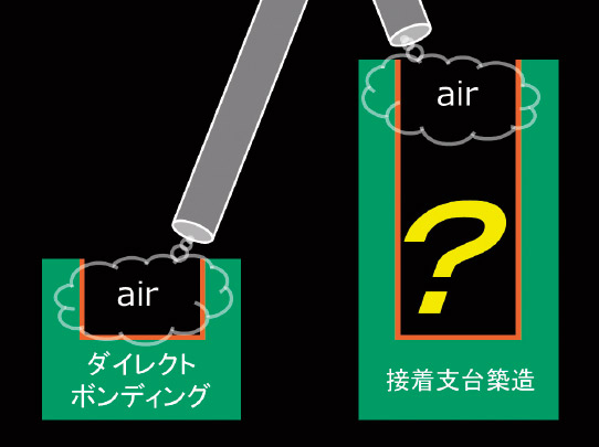 図7　細くて深いポスト形状では、通常のエアブローでポスト先端まで届くとは考えにくく、細ノズルを併用したブローや根管内バキュームでの吸引等の工夫が必要となる。