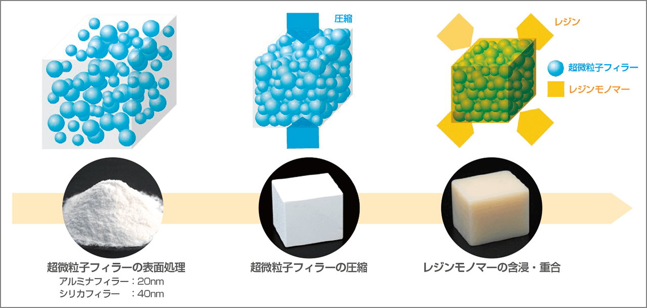 フィラー圧縮レジン含浸法