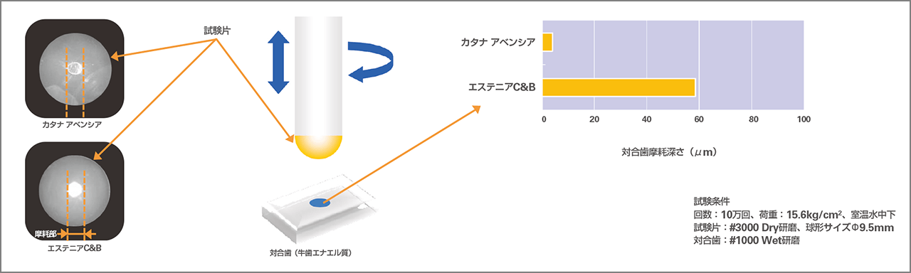 修復物、対合歯摩耗