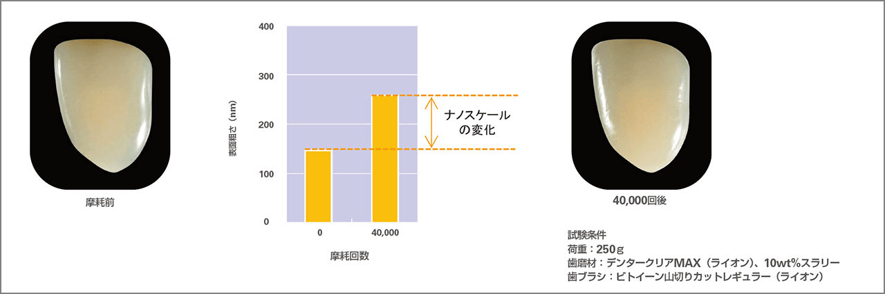 歯ブラシ摩耗