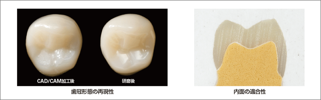 加工した小臼歯クラウン