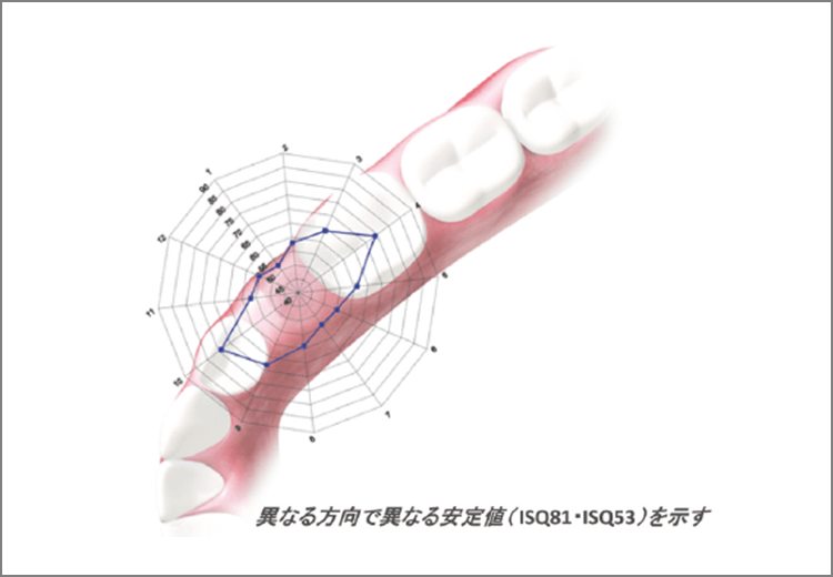 測定方向によるISQ値のちがい