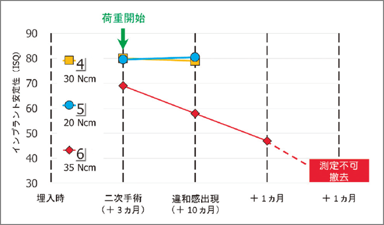 ISQ値の経時的変化（症例3）