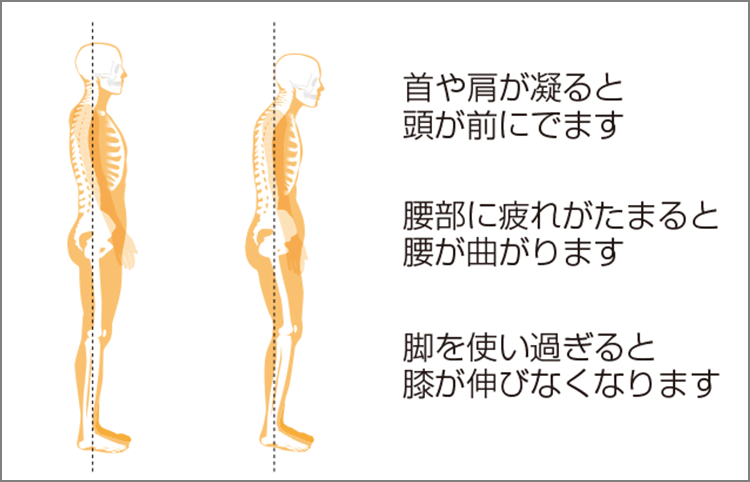 筋肉のトラブル、それは縮んで元に戻らないこと