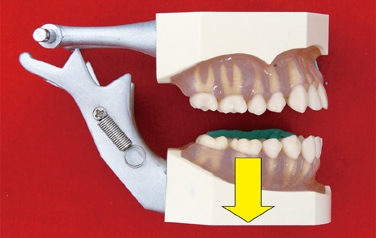 図5 顎が落下するイメージが良い（このようにすると、実際の運動では、まず回転運動が優先的におこります）。