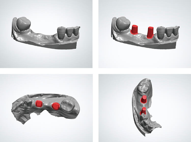 ⑮〜⑱ 3shape 3D Viewerを用いてユーザー側にてデザインを確認していただく。