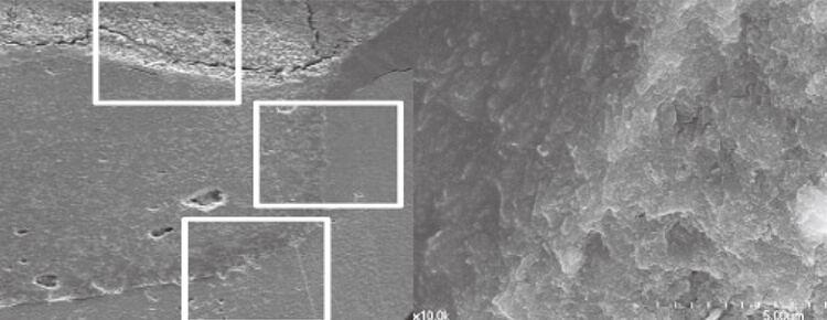 深い窩洞にBioMTAをベース材として用いる時、窩壁によって化学結合が達成される。