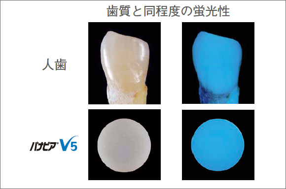 図3 天然歯と同程度の蛍光性を有する。