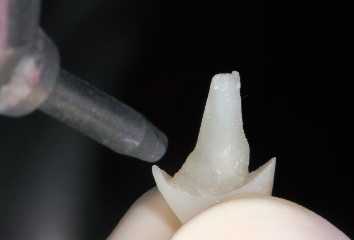 図12- i 支台歯に試適後、接着面にサンドブラスト処理を行う。