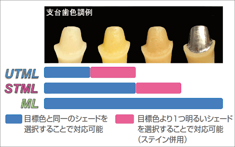 図10 対応可能な支台歯色調