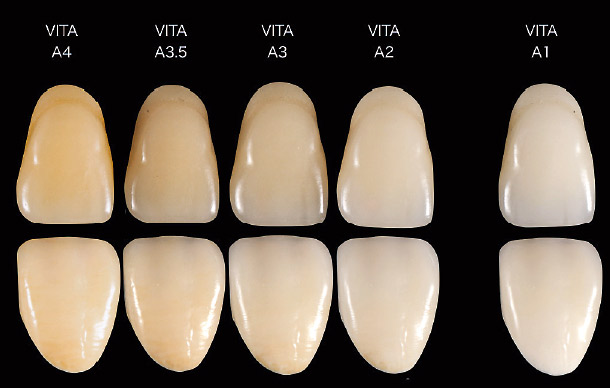 図3 カラーコート用いたビタA系色A2〜A4の再現例である。目標とするビタシェードガイドを参考にUBにA+を塗り重ねる。（A1との比色はUBにクリアー１のみ塗布した状態）