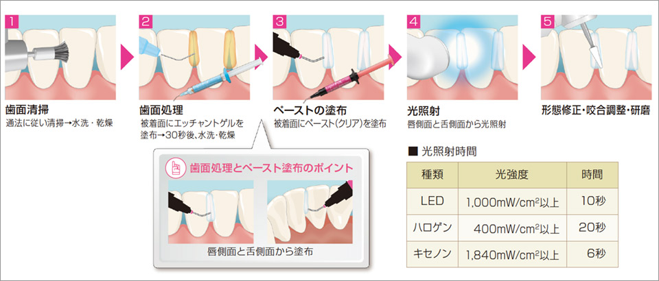 図4 使用方法