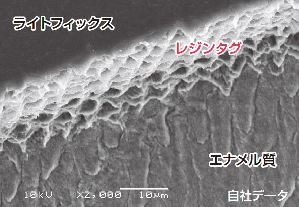 図9 ヒト歯未研削エナメル質とライトフィックスとの接着界面のSEM像