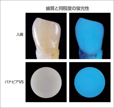 図7 歯質と同程度の蛍光性が付与されており、高度な審美修復にも対応できる。