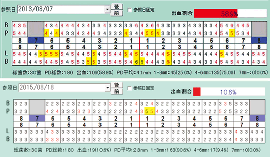 図10 歯周組織検査表