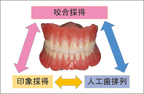 図1 総義歯に重要と思われる3つのエッセンス。特に咬合採得は患者満足度に直結する。（技工：Defy須藤哲也氏）