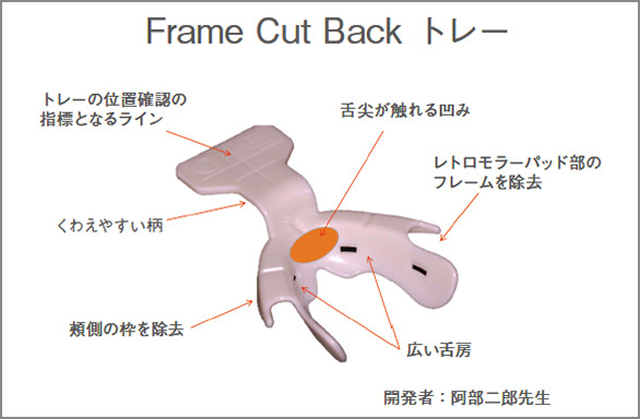 図5-1 フレームカットバックトレー（株式会社YDM）。閉口安静時の口腔内形態の採得により、各個トレーの設計線が的確になる。