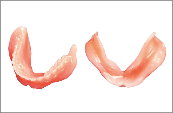 図20 吸着義歯の研磨面形態モデル（ニッシンT6-X.1301）。左側は吸着形態、右側は従来の形態として対比できる。