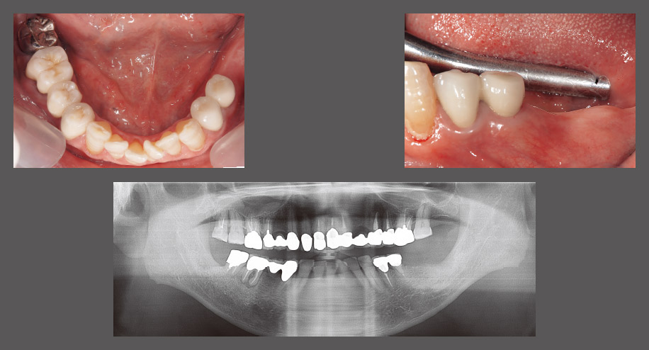 図9 初診時口腔内写真およびパノラマX線写真