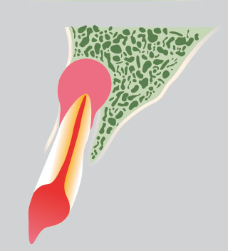 図14（CBCT）の模式図