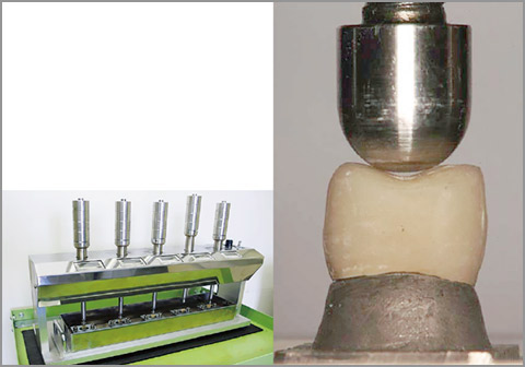 図8 繰り返し衝撃試験機にて、装着したCAD/CAMレジン冠が破折するまで衝撃を加え続ける。