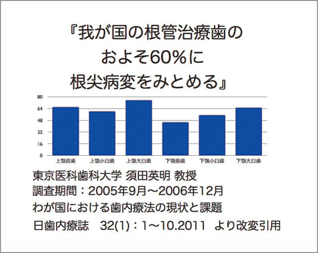 図1 既根充歯の根尖病変発現率（歯種別）