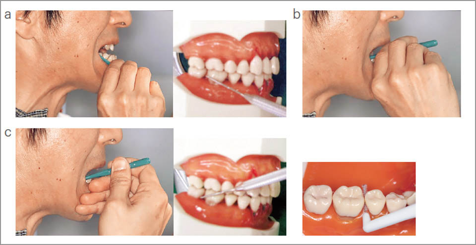 図11 下顎の歯間ブラシの挿入方向と把持法