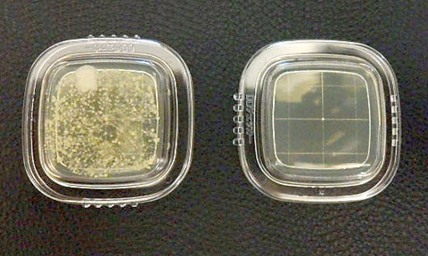 図3 スピットン表面の細菌培養（寒天培地；48時間培養）　左：清拭前　右:清拭後　
