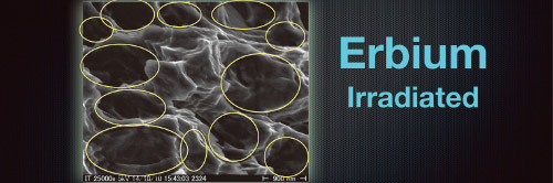 Erbium laserの水分子のWater Micro Explosionによる除染後の電顕像