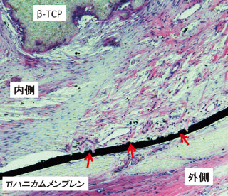 術後6週間目の病理組織像