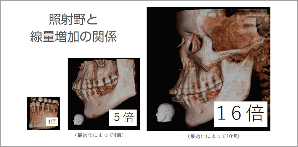 照射野が大きくなると被曝線量は非常に大きくなる。実際には、撮影条件等が最適化され抑制されている。