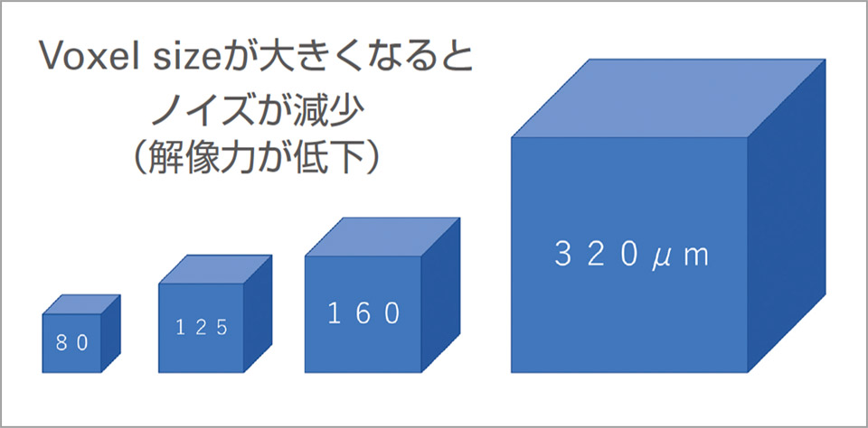 Voxel sizeを大きくするとノイズを低減できる。