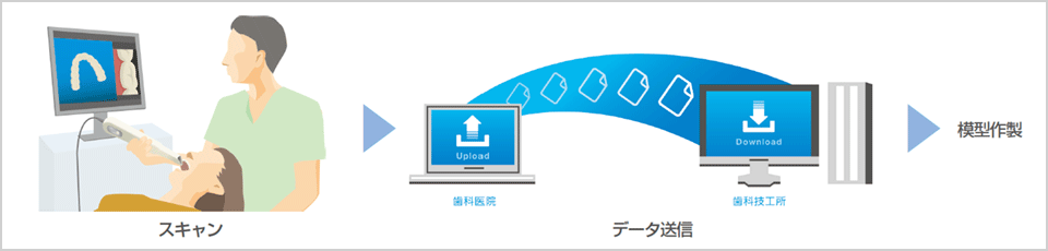 口腔内スキャナー導入による治療イメージ