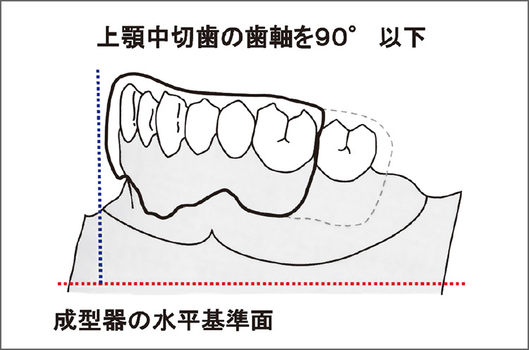 図12 成形器上への模型の設置