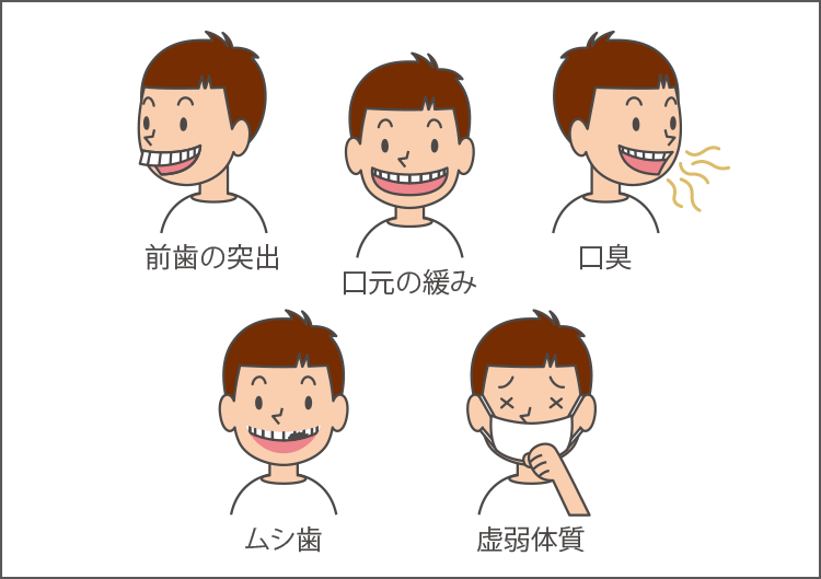 口呼吸によって起きる病気