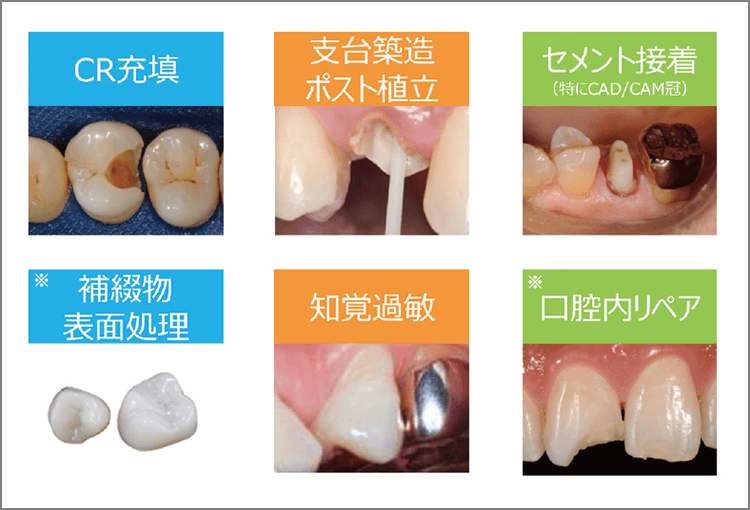 クリアフィル®ユニバーサルボンドQuick ERの主な使用用途