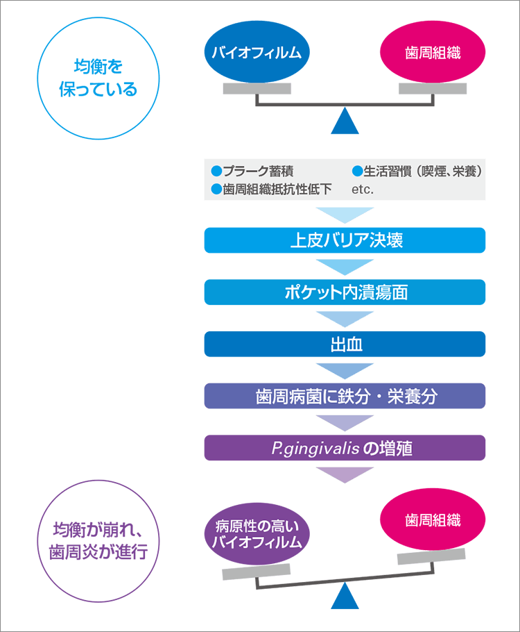 歯周病の発症過程のイメージ