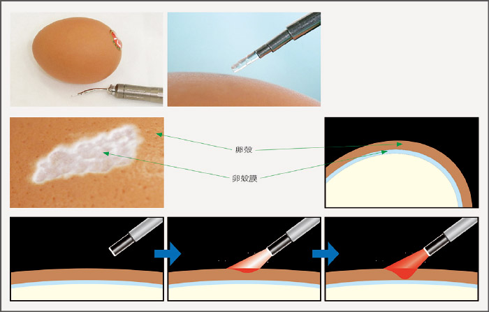 卵練習法の図