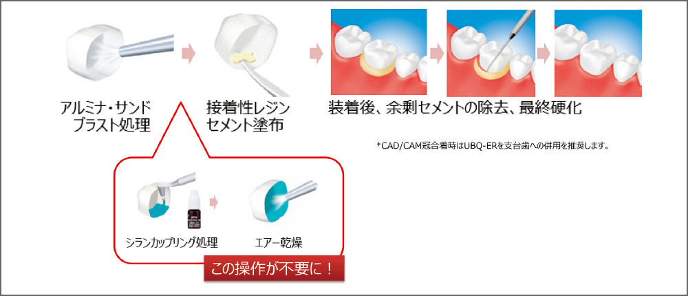 補綴装置の接着方法の図