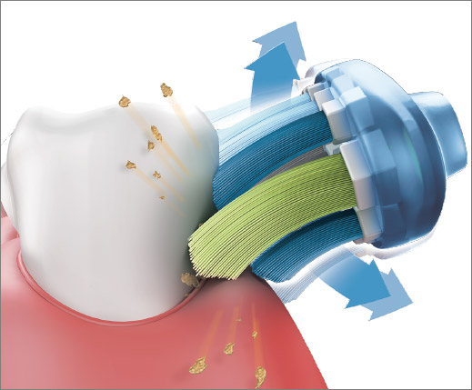 音波水流が、歯のすき間の歯垢まで除去するイメージ