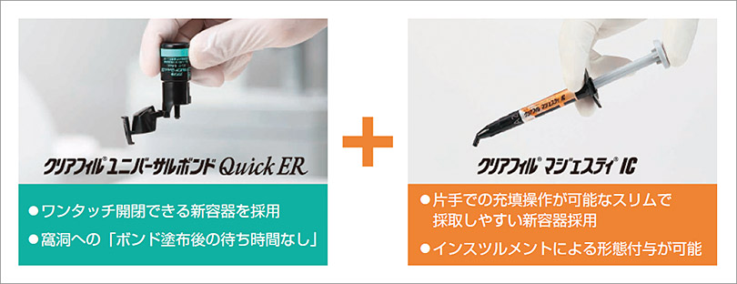 「クリアフィル® ユニバーサルボンドQuick ER」と「クリアフィル® マジェスティ® IC」の写真