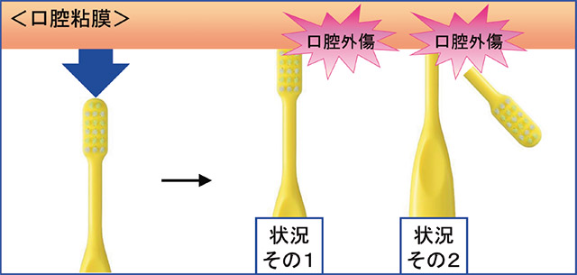 転倒による外傷の発生状況の図