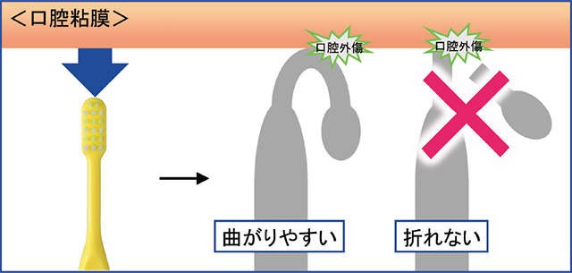 外傷の程度を小さくするためのイメージ図